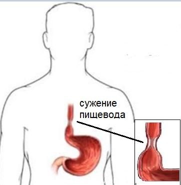 Лечение ногтей в Израиле: цены, отзывы, клиника Лечение ногтей в Израиле: цены, отзывы, клиника