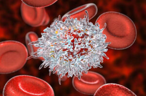 Лечение волосатоклеточного лейкоза в Израиле