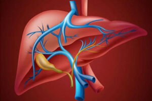 Лечение портальной гипертензии в Израиле