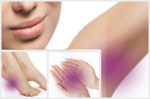 Лечение гипергидроза в Израиле