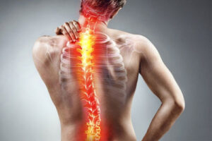 Лечение позвоночника в Израиле