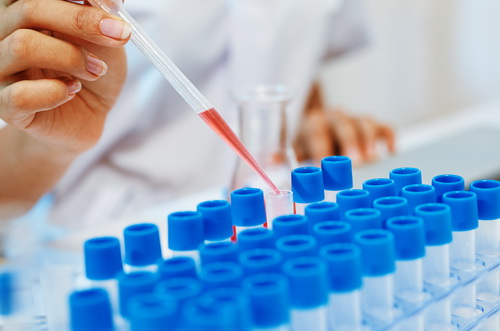 Лечение меланомы в Израиле | Ихилов