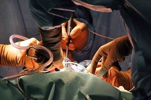 Замена аортального клапана в Израиле