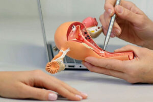 Лечение кисты бартолиновой железы в Израиле