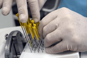 Контактная брахитерапия