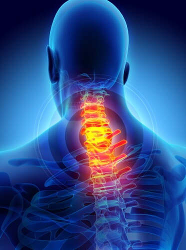 Лечение кифоза в Израиле | Ихилов