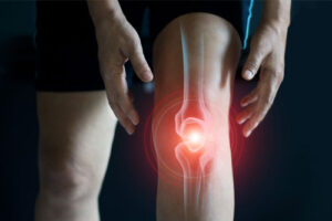 Лечение остеохондромы в Израиле