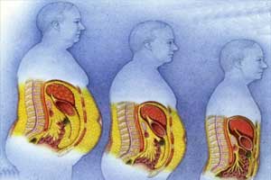 Диагностика метастазов в брюшной полости