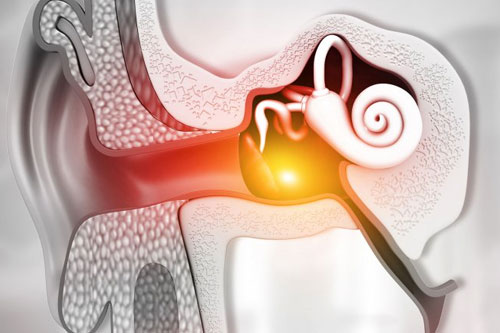 Лечение лабиринтита в Израиле