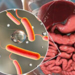 Токсин холеры против рака кишечника